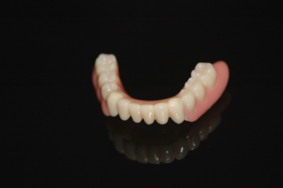 zweitprothese2